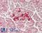 Propionyl-CoA Carboxylase Subunit Beta antibody, LS-B14893, Lifespan Biosciences, Immunohistochemistry paraffin image 