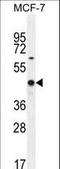 WT1 Transcription Factor antibody, LS-C160643, Lifespan Biosciences, Western Blot image 
