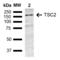 TSC Complex Subunit 2 antibody, LS-C777205, Lifespan Biosciences, Western Blot image 