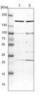 Nuclear Receptor Binding SET Domain Protein 2 antibody, PA5-53385, Invitrogen Antibodies, Western Blot image 