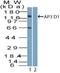 Adaptor Related Protein Complex 3 Subunit Delta 1 antibody, NBP2-27158, Novus Biologicals, Western Blot image 
