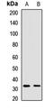 Syntaxin 12 antibody, LS-C668928, Lifespan Biosciences, Western Blot image 