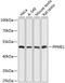 Protein Phosphatase Methylesterase 1 antibody, A08083, Boster Biological Technology, Western Blot image 