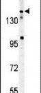 Castor Zinc Finger 1 antibody, PA5-23743, Invitrogen Antibodies, Western Blot image 