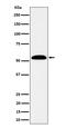 Aldehyde Dehydrogenase 7 Family Member A1 antibody, M03712-1, Boster Biological Technology, Western Blot image 