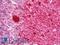 Deoxycytidine Kinase antibody, LS-B10837, Lifespan Biosciences, Immunohistochemistry frozen image 