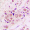 Zinc Finger CCCH-Type Containing 8 antibody, LS-C353590, Lifespan Biosciences, Immunohistochemistry paraffin image 