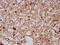 Neuronal Cell Adhesion Molecule antibody, LS-C671417, Lifespan Biosciences, Immunohistochemistry paraffin image 