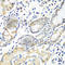 Ezrin antibody, A0703, ABclonal Technology, Immunohistochemistry paraffin image 