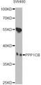 Protein Phosphatase 1 Catalytic Subunit Beta antibody, LS-C748575, Lifespan Biosciences, Western Blot image 