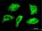 Myosin Heavy Chain 9 antibody, H00004627-M05, Novus Biologicals, Immunofluorescence image 