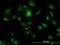 Hepatocyte Growth Factor-Regulated Tyrosine Kinase Substrate antibody, H00009146-M01, Novus Biologicals, Immunofluorescence image 