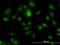 HGS antibody, H00009146-M01, Novus Biologicals, Immunofluorescence image 