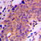 Ubiquitin Specific Peptidase 19 antibody, LS-C353286, Lifespan Biosciences, Immunohistochemistry paraffin image 