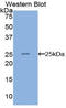 Hepatocellular carcinoma-associated protein TD26 homolog antibody, LS-B15035, Lifespan Biosciences, Western Blot image 