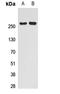 Nuclear Receptor Corepressor 2 antibody, LS-C368436, Lifespan Biosciences, Western Blot image 
