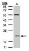 Actin Related Protein 2/3 Complex Subunit 3 antibody, TA307985, Origene, Western Blot image 