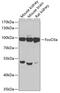 Forkhead Box O3 antibody, 13-033, ProSci, Western Blot image 