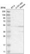 Actin Like 6A antibody, NBP2-55376, Novus Biologicals, Western Blot image 