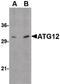 Autophagy Related 12 antibody, PA5-20463, Invitrogen Antibodies, Western Blot image 