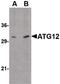 Autophagy Related 12 antibody, PA5-20463, Invitrogen Antibodies, Western Blot image 