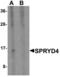 SPRY Domain Containing 4 antibody, LS-C144395, Lifespan Biosciences, Western Blot image 