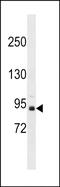Zinc Finger And BTB Domain Containing 49 antibody, PA5-48896, Invitrogen Antibodies, Western Blot image 