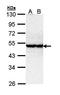 Serine/Threonine Kinase 40 antibody, orb69956, Biorbyt, Western Blot image 