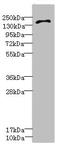 Glutamate Ionotropic Receptor NMDA Type Subunit 2D antibody, LS-C675835, Lifespan Biosciences, Western Blot image 