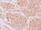 NADH:Ubiquinone Oxidoreductase Subunit S5 antibody, NBP2-19506, Novus Biologicals, Immunohistochemistry paraffin image 