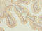 O-Sialoglycoprotein Endopeptidase Like 1 antibody, LS-C676214, Lifespan Biosciences, Immunohistochemistry paraffin image 