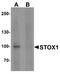 Storkhead Box 1 antibody, A07602, Boster Biological Technology, Western Blot image 