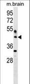 Hyaluronan and proteoglycan link protein 4 antibody, LS-C159807, Lifespan Biosciences, Western Blot image 