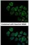 Interferon Alpha And Beta Receptor Subunit 2 antibody, PA5-28303, Invitrogen Antibodies, Immunofluorescence image 