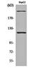 Zinc Finger Protein 638 antibody, orb162047, Biorbyt, Western Blot image 