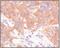 Keratin 5 antibody, 32-143, ProSci, Immunohistochemistry frozen image 