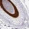 Keratin 25 antibody, HPA053977, Atlas Antibodies, Immunohistochemistry paraffin image 