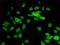 Lysyl Oxidase Like 1 antibody, H00004016-D01P, Novus Biologicals, Immunocytochemistry image 