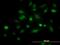 Signal Transducer And Activator Of Transcription 5B antibody, orb94769, Biorbyt, Immunofluorescence image 