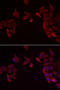 Receptor Activity Modifying Protein 3 antibody, STJ28798, St John