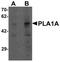 Phospholipase A1 Member A antibody, PA5-34460, Invitrogen Antibodies, Western Blot image 