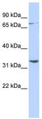 Dpy-19 Like C-Mannosyltransferase 1 antibody, TA331961, Origene, Western Blot image 
