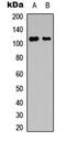 Nuclear Factor Of Activated T Cells 3 antibody, MBS8203871, MyBioSource, Western Blot image 