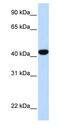 Fumarylacetoacetate Hydrolase antibody, ab83770, Abcam, Western Blot image 