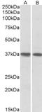 Kruppel Like Factor 2 antibody, STJ70192, St John