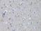 Myosin Heavy Chain 10 antibody, LS-C747237, Lifespan Biosciences, Immunohistochemistry paraffin image 