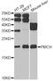 Pro-Melanin Concentrating Hormone antibody, STJ28775, St John