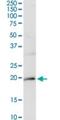 CD247 Molecule antibody, H00000919-D01P, Novus Biologicals, Western Blot image 