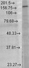 Glutamate Ionotropic Receptor NMDA Type Subunit 2B antibody, LS-C227723, Lifespan Biosciences, Western Blot image 