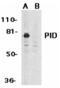 Metastasis Associated 1 Family Member 2 antibody, A03073, Boster Biological Technology, Western Blot image 